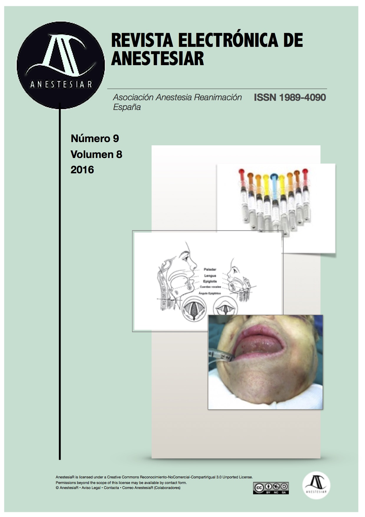 					Ver Vol. 8 Núm. 9 (2016): Revista Electrónica de AnestesiaR
				