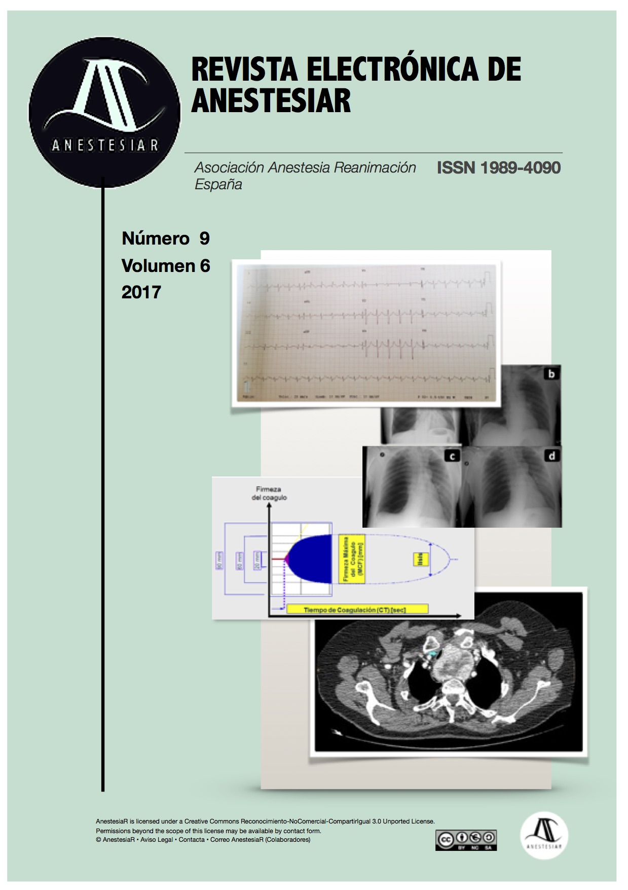 					Ver Vol. 9 Núm. 7 (2017): Revista Electrónica de AnestesiaR
				