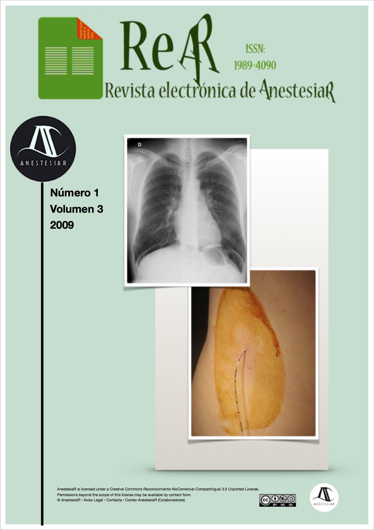 					Ver Vol. 1 Núm. 3 (2009): Revista Electrónica de  AnestesiAR
				